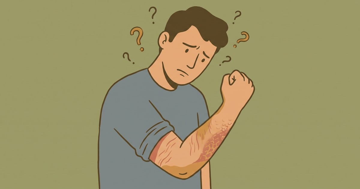 Piel que pica, piel que arde: cuando la sequedad de toda la vida deja de ser solo una molestia